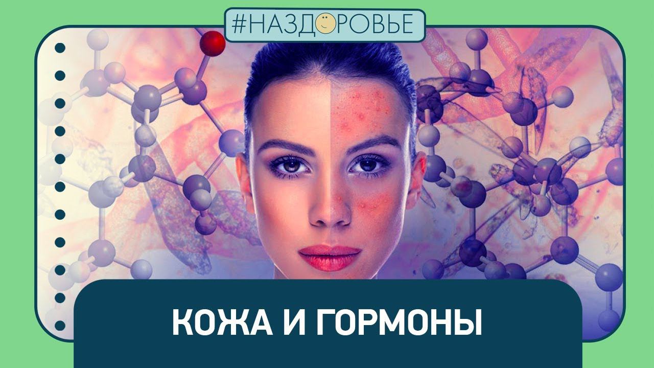 #НАЗДОРОВЬЕ: кожа и гормоны