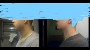 1 год результата мьюинга, объяснения где новые ролики. Mewing по русски.