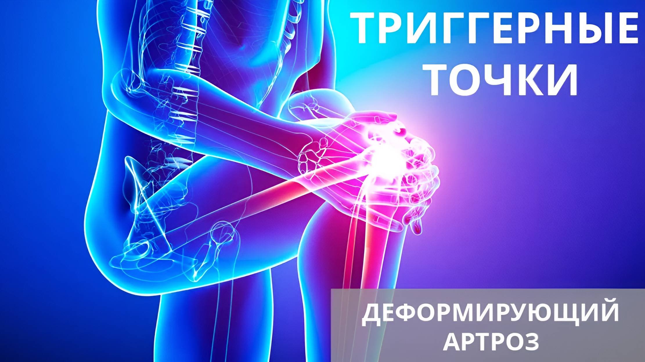 Триггерные точки и деформирующий артроз
 #артроз #триггерныеточки