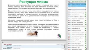 !Миома Матки Симптомы Размеры!|!Mioma Matki Simptomy Razmery!