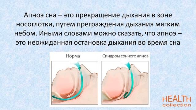 В чем опасность храпа? смотреть онлайн