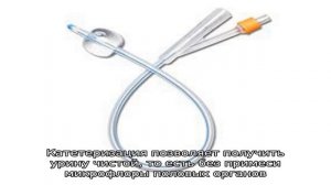 Катетеризация мочеточника