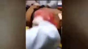 Сердце выпрыгнуло в прямом смысле от инергетика
