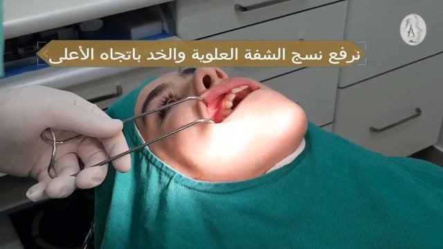 Infra orbital injection: prof Bassel Brad смотреть онлайн