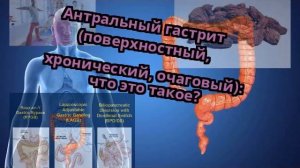 Антральный гастрит (поверхностный, хронический, очаговый): что это такое?