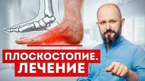 Как убрать плоскостопие? БЫСТРАЯ диагностика и лечение БЕЗ ОПЕРАЦИИ!