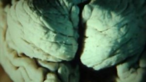 Проводящие пути спинного и головного мозга. Анатомия мозга