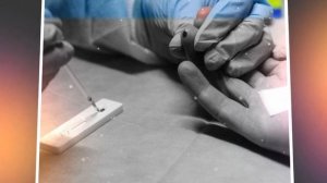 ★ Стадии рака. Самые распространённые виды рака. Причины развития онкологии.