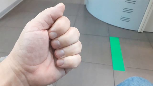 Болезнь нотта или щелкающий палец смотреть онлайн