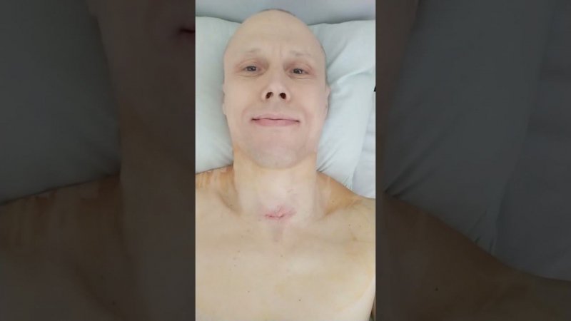 После операции по удалению щитовидной железы