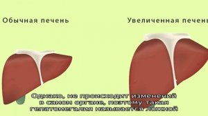 Причины гепатомегалии у новорожденных детей и грудничков