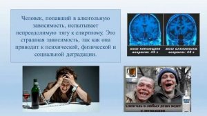 Нервная система. Тема 9. Гигиена нервной системы