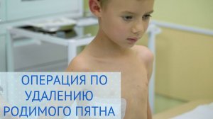 ⚕️ Операция по удалению родимого пятна в Европейском Медицинском Центре