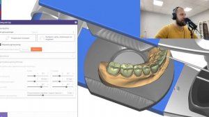 Разбор цифрового waxup exocad