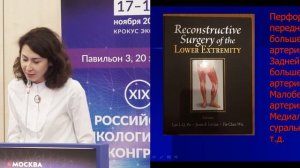 Выбор метода реконструкции дефектов стопы и голени у пациентов с ЗНО костей кожи и мягких тканей