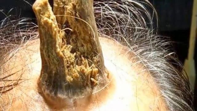 На лбу индийца появился «дьявольский» рог: опубликованы жуткие фото смотреть онлайн