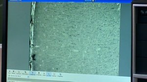 Гистология Мозжечек Кора Больших полушарий  [Нервная система]