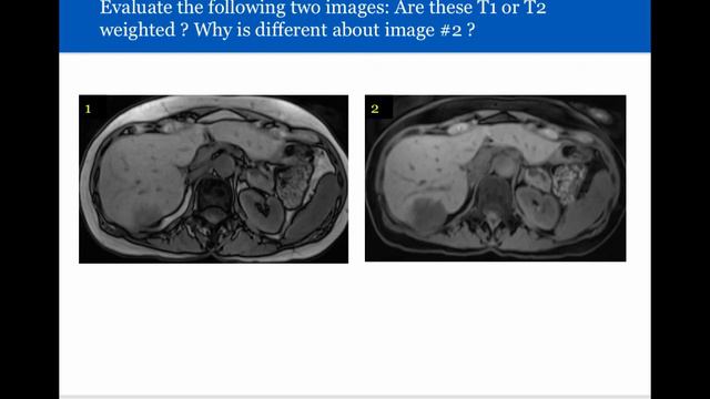 Introduction to Radiology: Magnetic Resonance Imaging