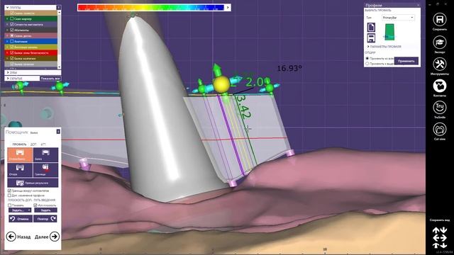 EXOCAD Моделировка Балки на трёх опорах смотреть онлайн