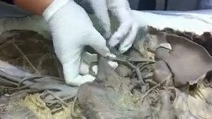 Анатомия человека. Артерии и вены.