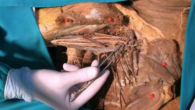 Fossa axillaris (HD) смотреть онлайн