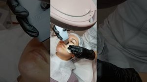 Ультразвуковая чистка лица и миндальный пилинг в студии Yarko