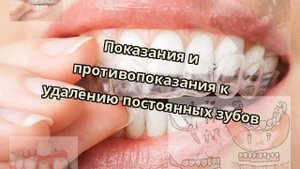 Показания и противопоказания к удалению постоянных зубов