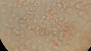 Съел крапиву. Это опасно? Что крапива делает с кровью!