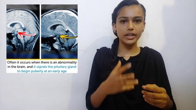 5-Years Girl. Who gave birth??? | Lina Medina | Explained in tamil | Anamikha Manoharan смотреть онлайн