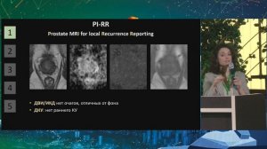01  Рак предстательной железы после лечения  чек лист рентгенолога   Трофименко Ирина Анатольевна
