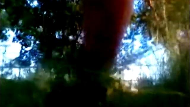1-е видео после перелома.