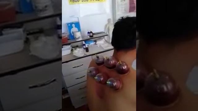 Кровопускание, Хиджама оздоровление всего организма.