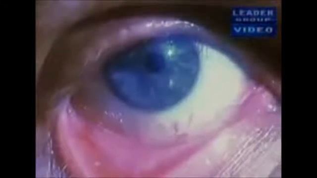 ПАРАЗИТЫ ВО ВСЁМ ТЕЛЕ!!! СМОТРЕТЬ ВСЕМ!!! смотреть онлайн