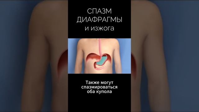 Главная причина ИЗЖОГИ, ОТРЫЖКИ, ГЭРБ, рефлюкса