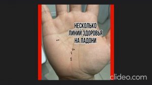 Несколько Линий Здоровья на ладони