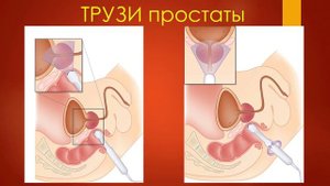 УЗИ простаты. УЗИ в урологии - 2021. Станислав Феданов