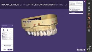 Simplify your design journey with exocad's DentalCAD 3.1 Rijeka