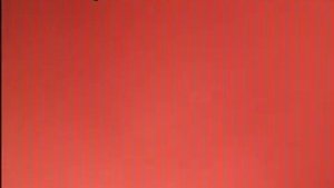 Видеоколоноскопия. Аденоматозный полип. Удаление