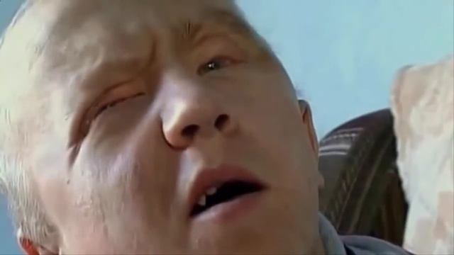Мутации человека!! Удивительная генетика!