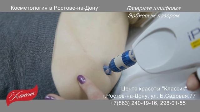 Лазерная шлифовка Эрбиевым лазером