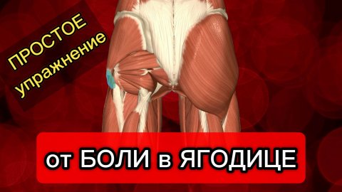 Боль в ЯГОДИЦЕ | Боль в ПОЯСНИЦЕ | Что делать?