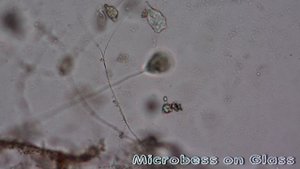 Болотная вода под микроскопом. Что можно увидеть на увеличении 200 крат.
