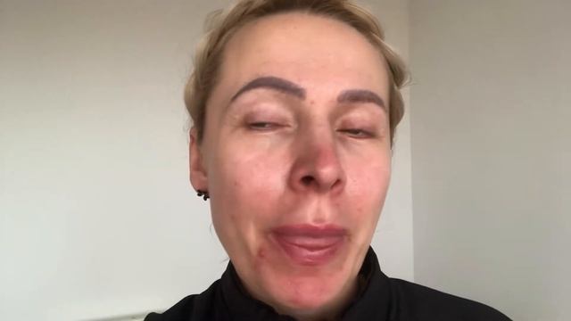 Как я избавляюсь от Розацеа и Акне . смотреть онлайн