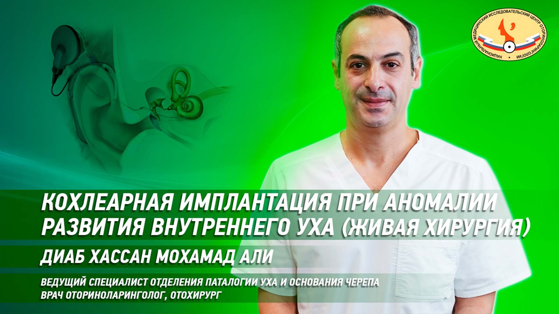 Кохлеарная имплантация при аномалии развития внутреннего уха - "живая хирургия"