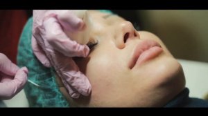 Коррекция и увеличение скул