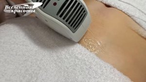 Как проходит процедура по фотоэпиляции