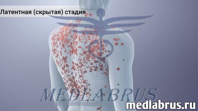 Сифилис-опасная инфекция, передающаяся половым путем.