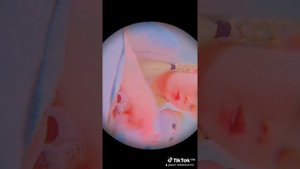2c7fc9a7-1577-4495-a312-05533848be7c-watermark.mp4
