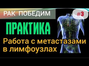 Уничтожаем метастазы в лимфоузлах. Практика. Методика ручного управления иммунитетом