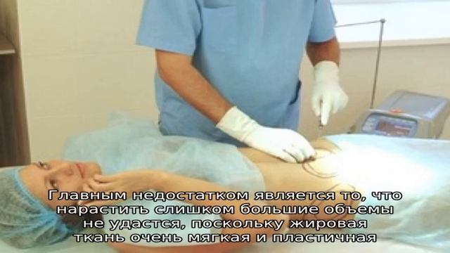 Липофилинг ног сделает их идеальными смотреть онлайн